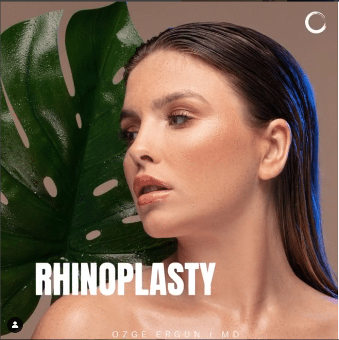 Rhinoplasty 61