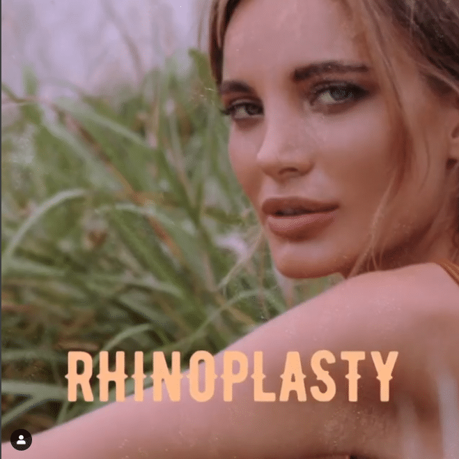 Rhinoplasty 3